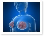 Research Papers on Breast Cancer